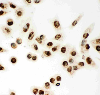 MCM7 Rabbit Polyclonal Antibody