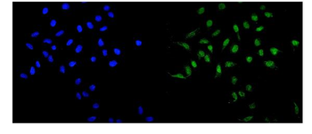 MAD1/MAD1L1 Rabbit Polyclonal Antibody