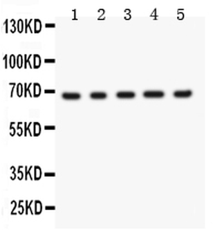 Menin/MEN1 Rabbit Polyclonal Antibody