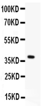 Menin/MEN1 Rabbit Polyclonal Antibody