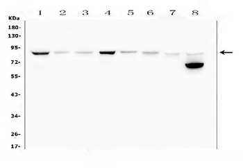 Mitofusin 2/MFN2 Rabbit Polyclonal Antibody