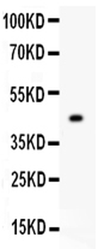 Mitofusin 2/MFN2 Rabbit Polyclonal Antibody