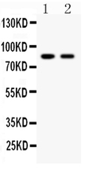 Mitofusin 2/MFN2 Rabbit Polyclonal Antibody