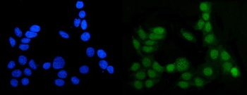 MGMT Antibody