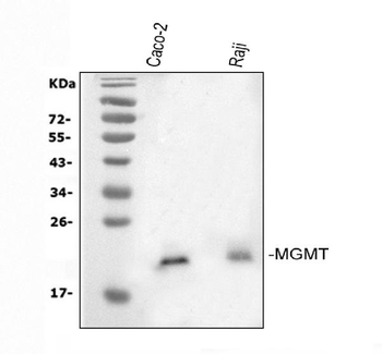 MGMT Antibody