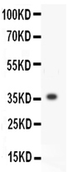 MMP3 Rabbit Polyclonal Antibody