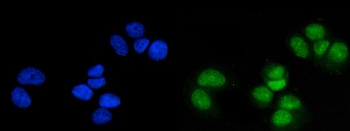 MSK1/RPS6KA5 Rabbit Polyclonal Antibody