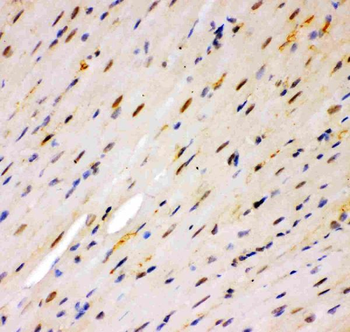 MSK1/RPS6KA5 Rabbit Polyclonal Antibody