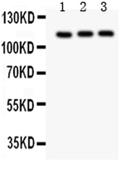 TRPC5 Rabbit Polyclonal Antibody