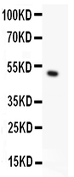 TRPC5 Rabbit Polyclonal Antibody
