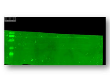 TRPC5 Rabbit Polyclonal Antibody