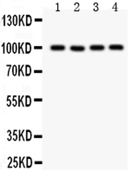 TRP 7/TRPC7 Rabbit Polyclonal Antibody