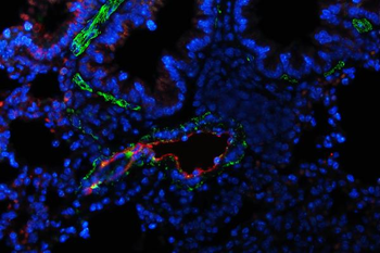 Von Willebrand Factor/VWF Antibody
