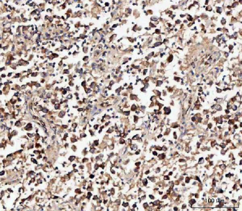 MIF Rabbit Polyclonal Antibody