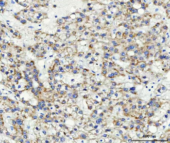 ABCB4 Rabbit Polyclonal Antibody