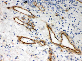 Heparan Sulfate Proteoglycan 2/HSPG2 Rabbit Polyclonal Antibody