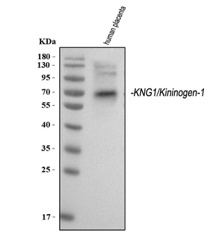 Kininogen 1/KNG1 Rabbit Polyclonal Antibody