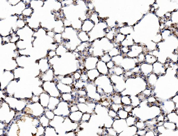 Galectin 3/LGALS3 Rabbit Polyclonal Antibody