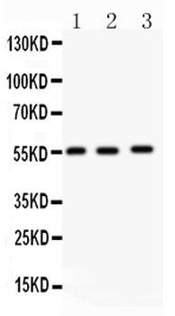 MMP14 Rabbit Polyclonal Antibody
