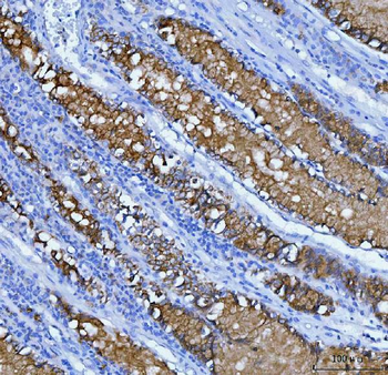 Mucin 5AC/MUC5AC Rabbit Polyclonal Antibody