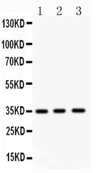 Nkx2.5/NKX2-5/NKX2 Rabbit Polyclonal Antibody