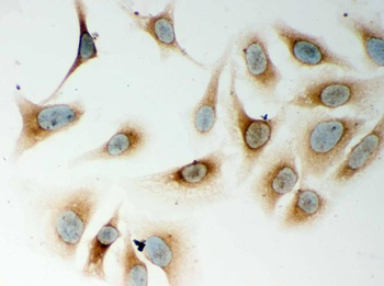 CARD4/NOD1 Rabbit Polyclonal Antibody