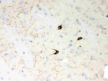 Neuropeptide Y/NPY Rabbit Polyclonal Antibody
