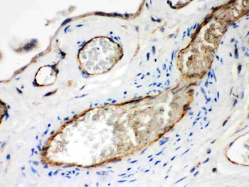Neuropilin 1/NRP1 Rabbit Polyclonal Antibody