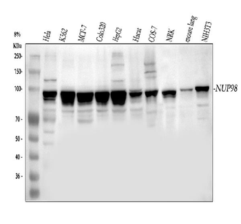 NUP98 Rabbit Polyclonal Antibody