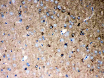 P2X5/P2RX5 Rabbit Polyclonal Antibody