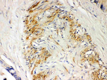Parkin/PRKN Rabbit Polyclonal Antibody