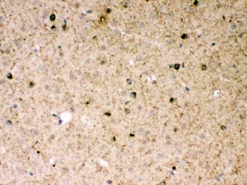 Parkin/PRKN Rabbit Polyclonal Antibody