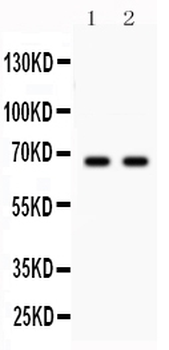 Parkin/PRKN Rabbit Polyclonal Antibody