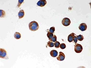 Parkin/PRKN Rabbit Polyclonal Antibody