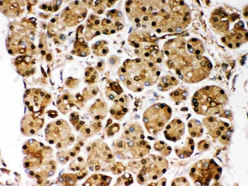 PARK7/DJ1 Rabbit Polyclonal Antibody