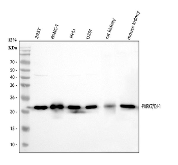 PARK7/DJ1 Rabbit Polyclonal Antibody