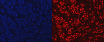 PARP/PARP1 Rabbit Polyclonal Antibody
