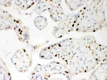 PARP/PARP1 Rabbit Polyclonal Antibody