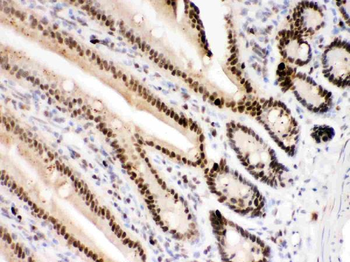 PARP/PARP1 Rabbit Polyclonal Antibody