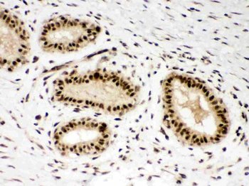 PBK Rabbit Polyclonal Antibody