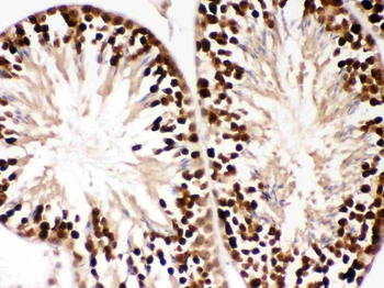 PBK Rabbit Polyclonal Antibody