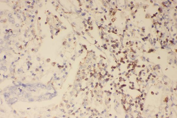 Profilin 1/PFN1 Antibody