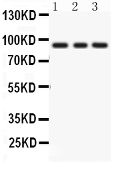 PKC epsilon/PRKCE Rabbit Polyclonal Antibody