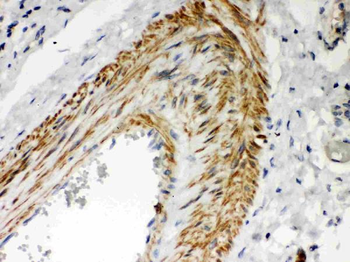 PKC iota/PRKCI Rabbit Polyclonal Antibody
