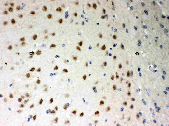 PKC iota/PRKCI Rabbit Polyclonal Antibody