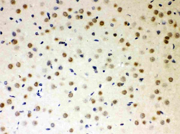PKC iota/PRKCI Rabbit Polyclonal Antibody