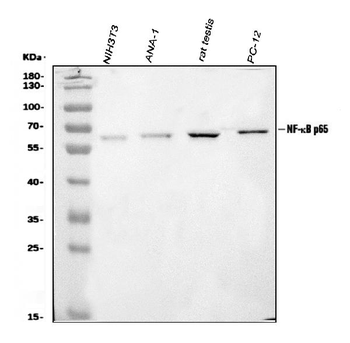 NF-kB p65/RELA/NF Rabbit Polyclonal Antibody
