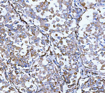 Hsp47/SERPINH1 Antibody