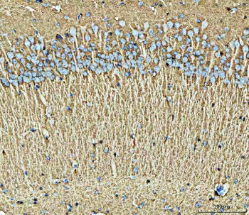 EAAT2/GLT-1/SLC1A2/GLT Rabbit Polyclonal Antibody