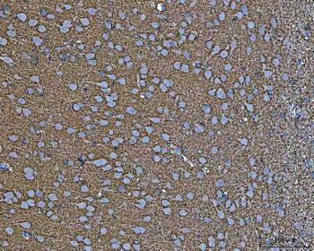 EAAT2/GLT-1/SLC1A2/GLT Rabbit Polyclonal Antibody